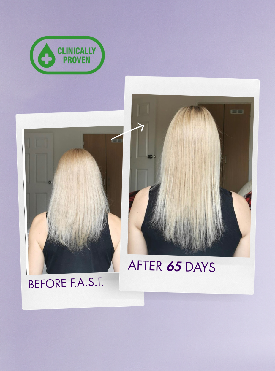 F.A.S.T. Starter Hair Boost Trio